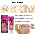 Aichun Beauty Anti Stretch Marks Removal Cream image 2