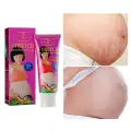 Aichun Beauty Anti Stretch Marks Removal Cream image 3