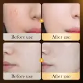 ZOZU 24k Gold Collagen Serum Whitening Essence Hyaluronic Acid Face Serum 30ml ZOZU51322 image 3