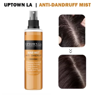 Anti Dandruff Hair Mist For Dandruff Removal and Itching Control For all Hair types