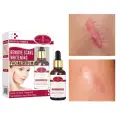Aichun Beayty Remover Scars Facial Serum - 30ML image 1