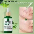 Anti Acne serum with Salicylic Acid for oil Control and acne removal 30 ml image 1