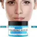 Hydro Boost Hyaluronic Acid Hydrating Gel Daily Face Moisturizer for Boosting Skin glow & Elasticity image 1
