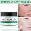Anti Acne Gel for Acne Prone Skin and Acne Scars Marks with Niacinamide and Salicylic Acid | Anti Acne Face Treatment for Dark Spots | 50 ml image 1