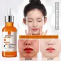 Vitamin C Brightening Serum for Face – Anti Aging Face Serum – Brightening Serum for Dark Spots, Even Skin Tone, Eye Area, Fine Lines & Wrinkles for all skin types 30 ml image 1