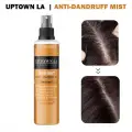 Anti Dandruff Hair Mist For Dandruff Removal and Itching Control For all Hair types image 1