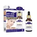 AICHUN BEAUTY Anti-Acne Facial Serum Aloe Vera Extract Salicylic Acid Repairs Damaged Skin 30ml image 1